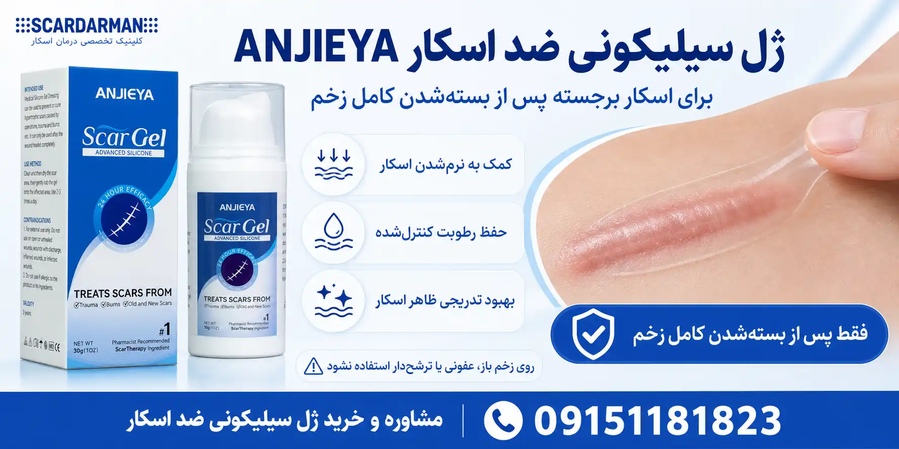 ژل سیلیکونی ضد اسکار ANJIEYA
