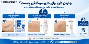 best-burn-scar-treatment