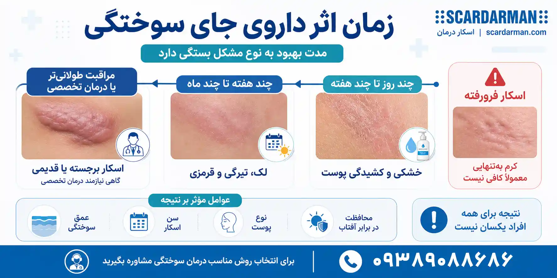 مدت&zwnj;زمان اثرگذاری دارو و محصولات ترمیم&zwnj;کننده جای سوختگی