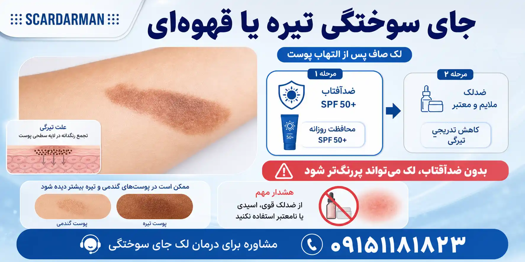 جای سوختگی تیره یا قهوه ای