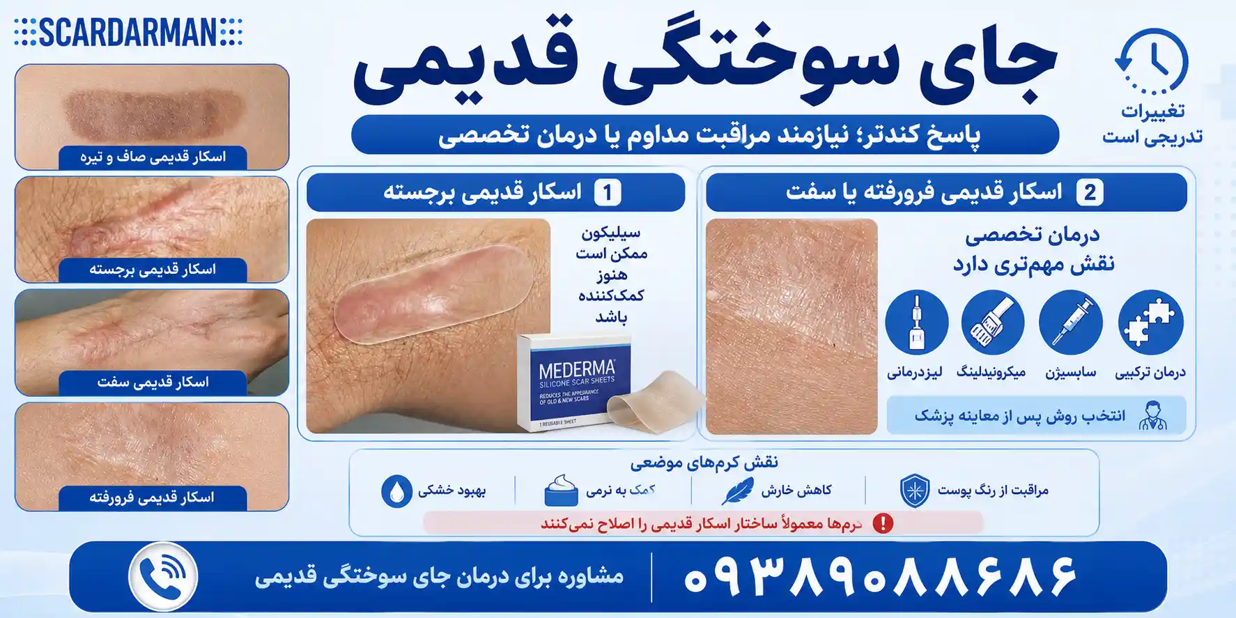جای سوختگی قدیمی