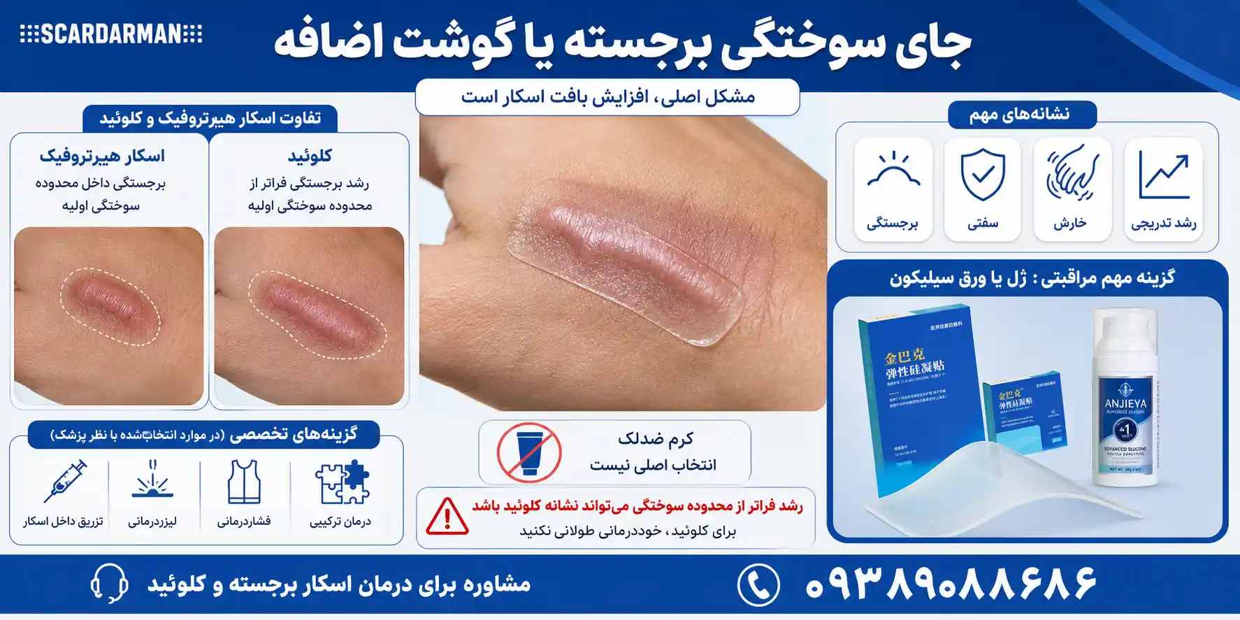 جای سوختگی برجسته