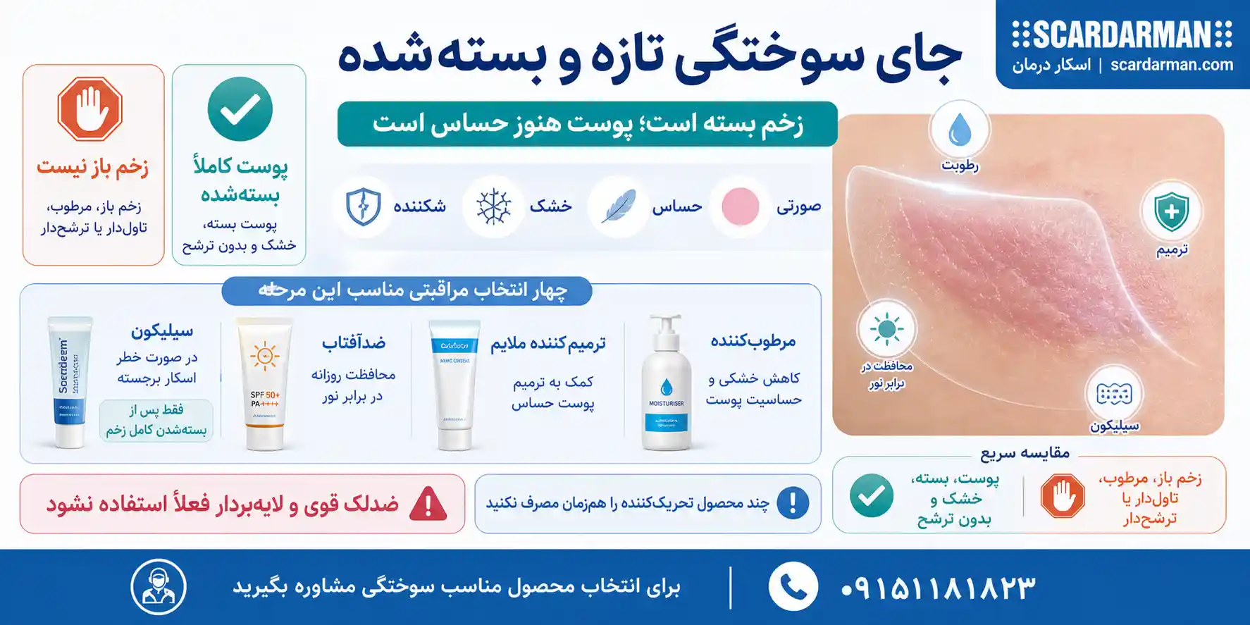 استفاده از مرطوب&zwnj;کننده و ترمیم&zwnj;کننده سد دفاعی پوست پس از سوختگی