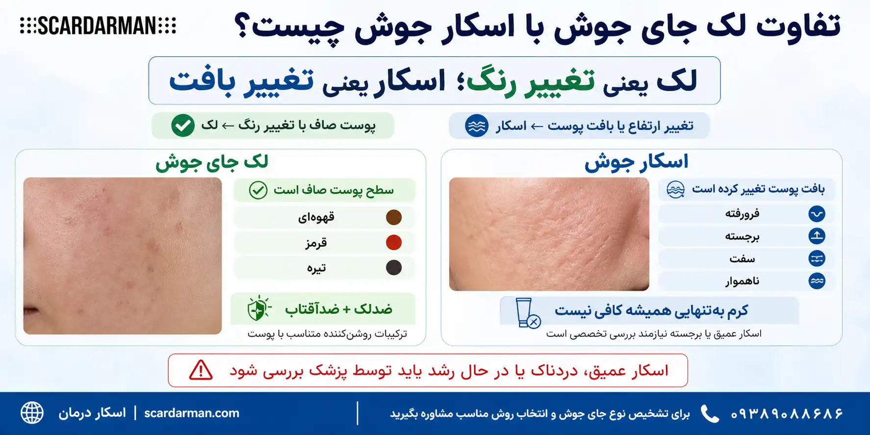 مقایسه تفاوت لک جای جوش با اسکار جوش