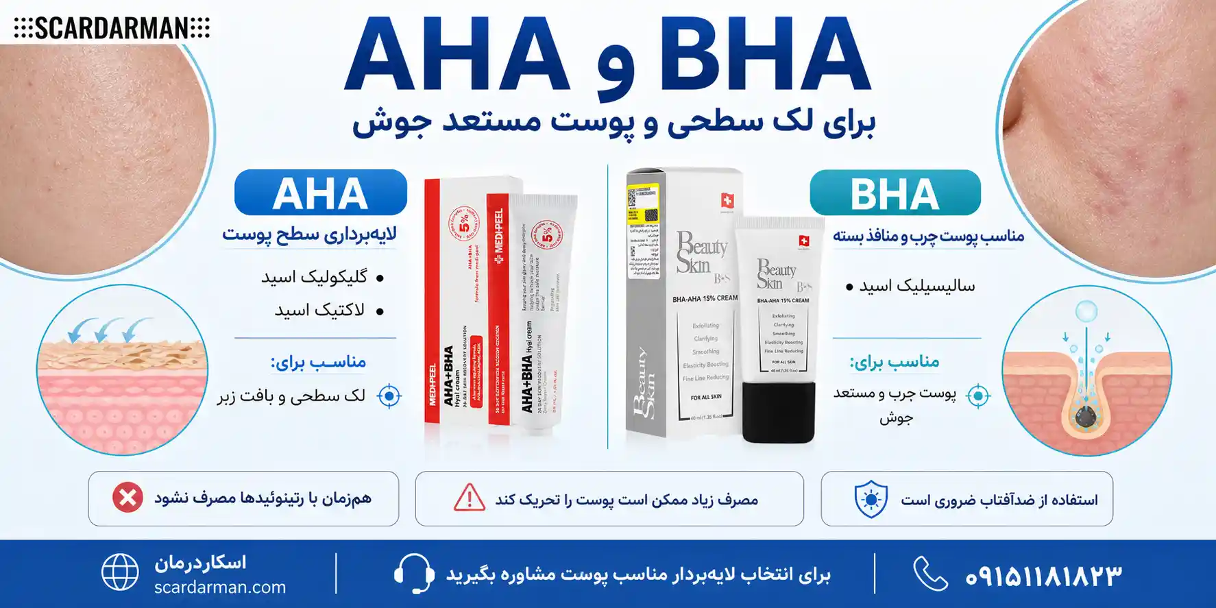 اسیدهای AHA و BHA برای لایه&zwnj;برداری پوست و بهبود جای جوش
