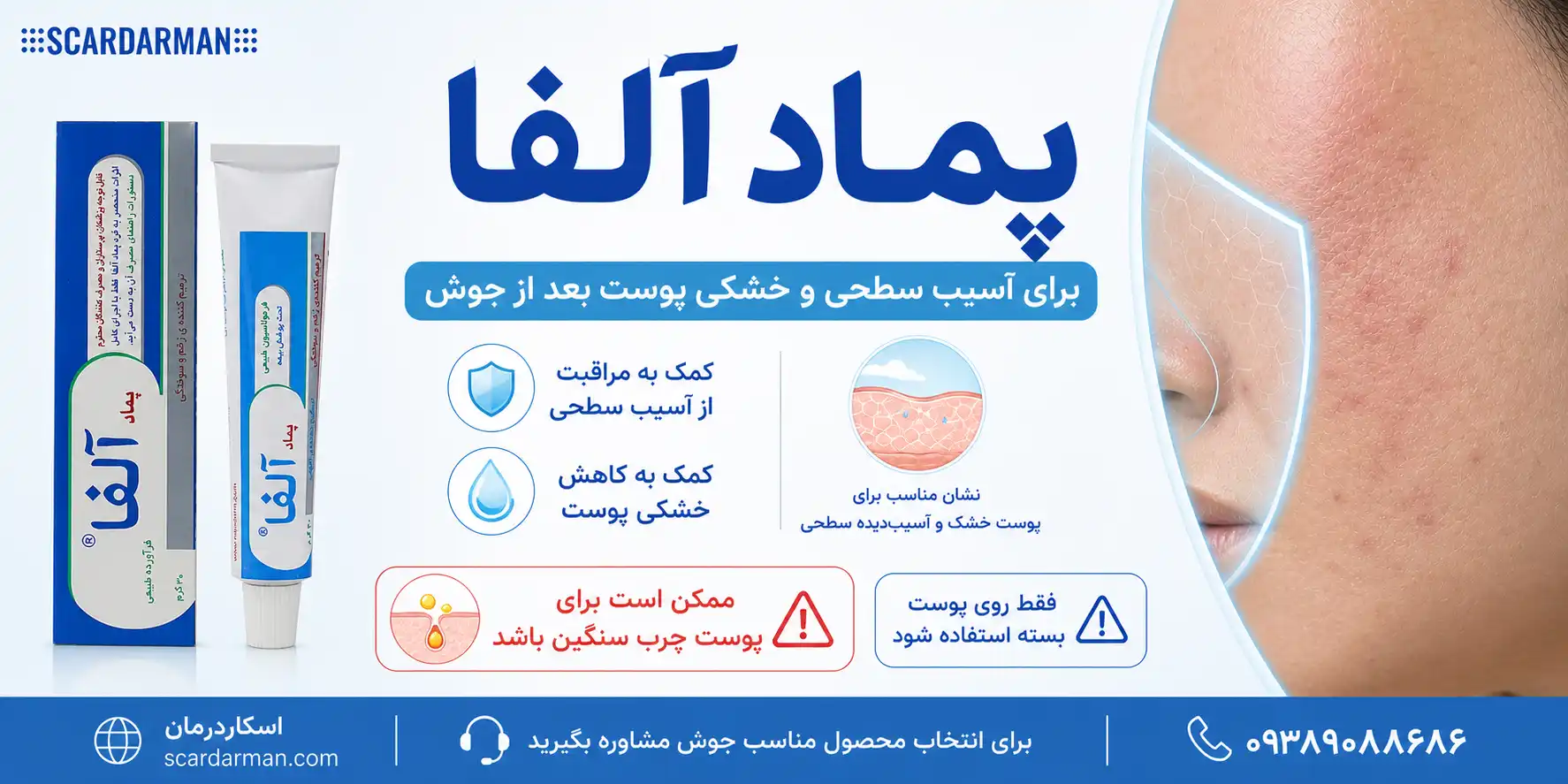 پماد آلفا برای جای جوش