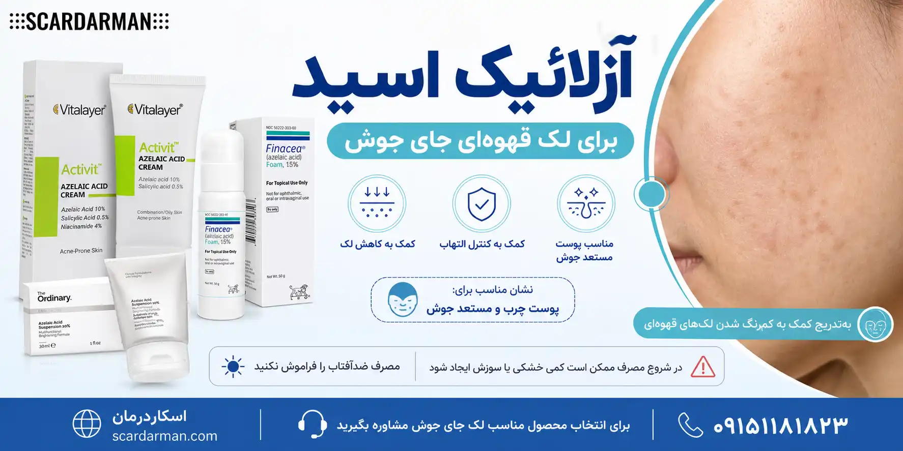 آزلائیک اسید