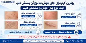 بهترین کرم برای درمان جای جوش صورت