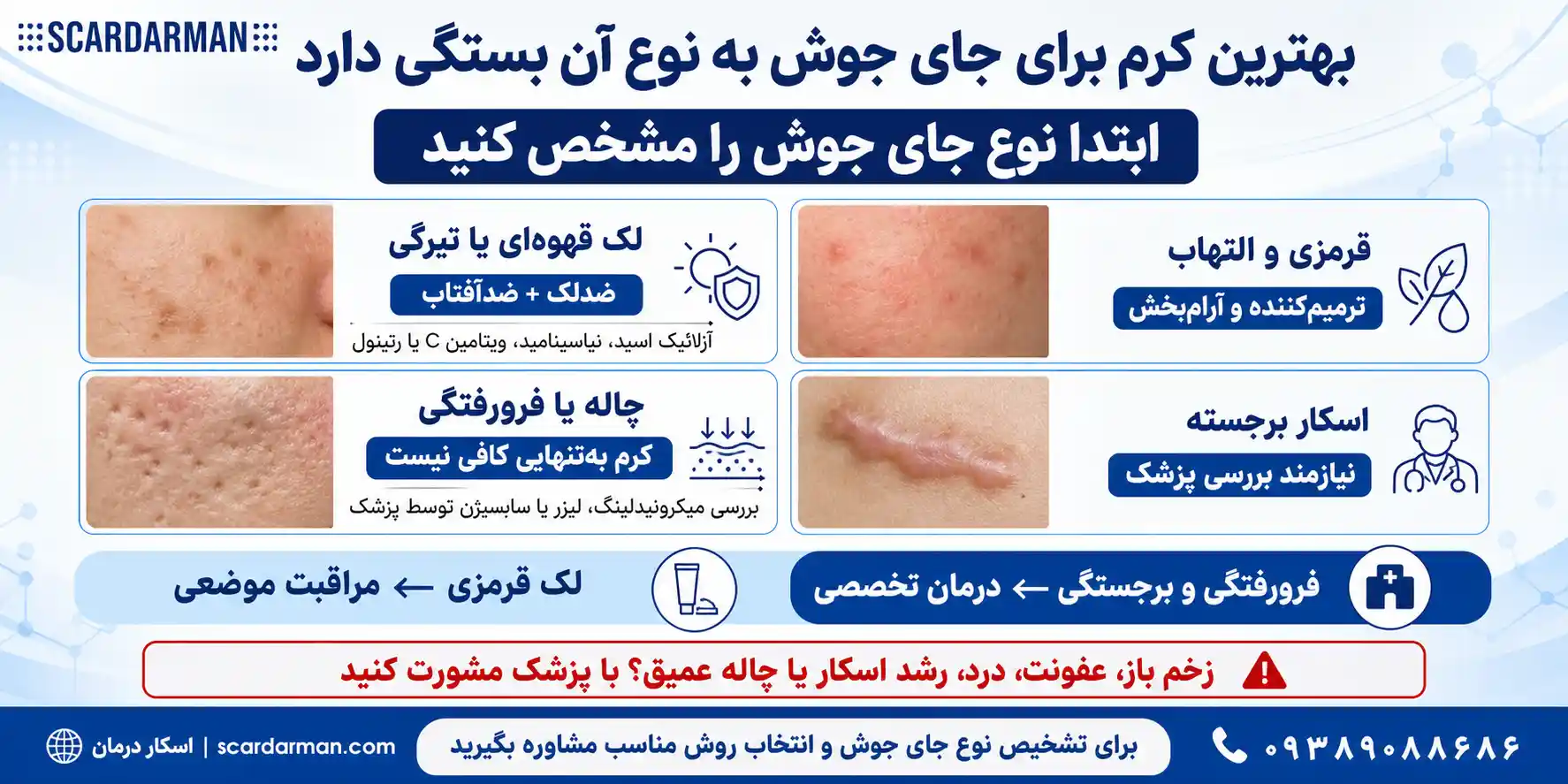 بهترین کرم برای درمان جای جوش صورت
