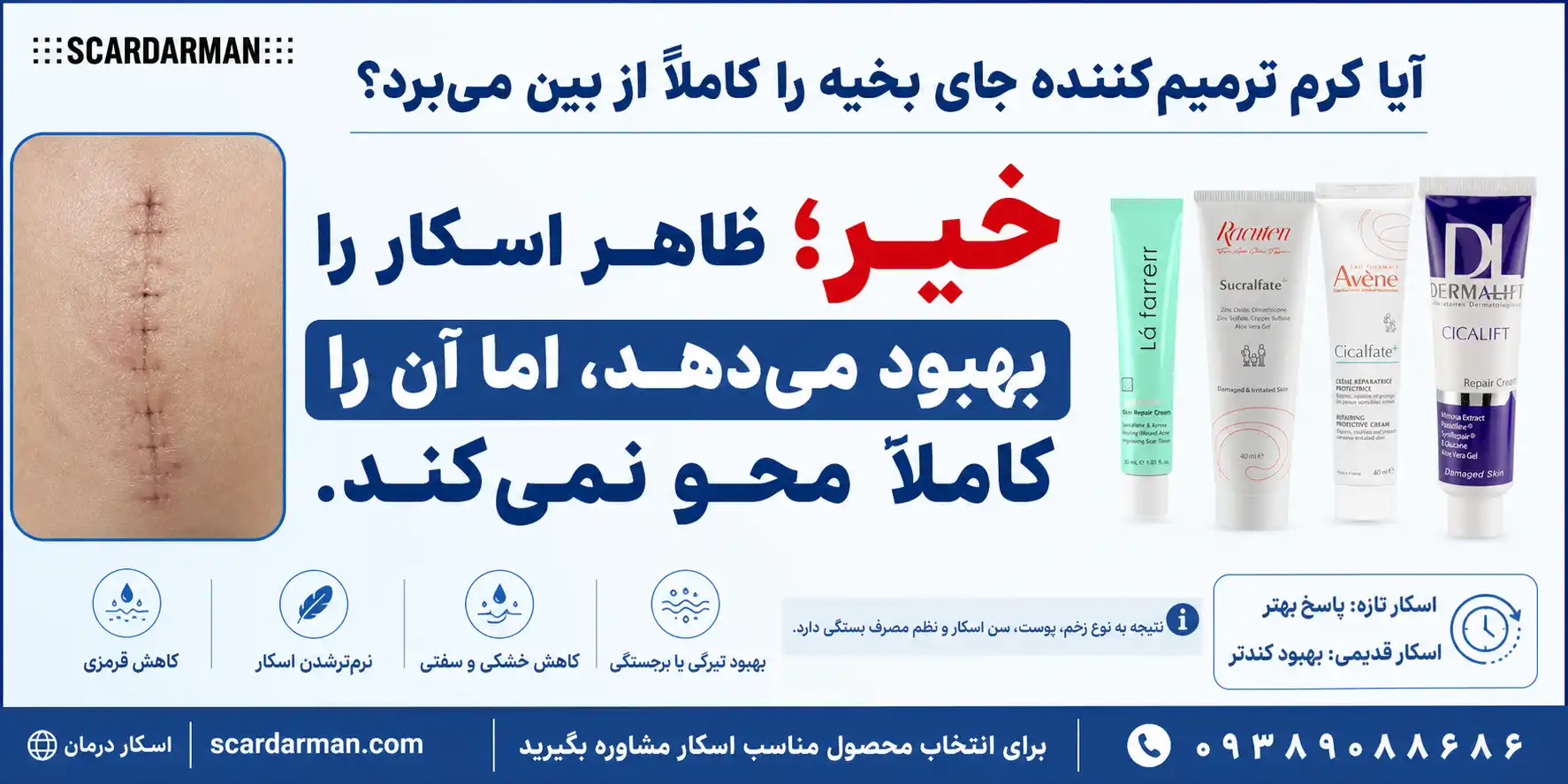 آیا کرم ترمیم کننده جای بخیه را کاملاً از بین می&zwnj;برد؟