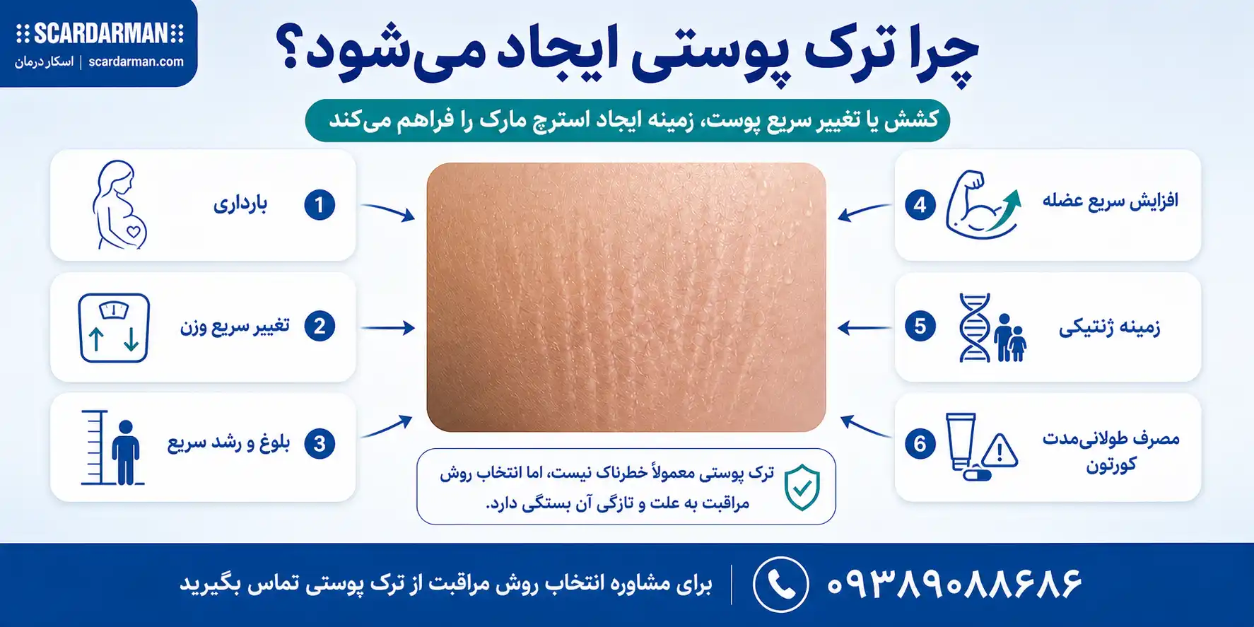 دلایل ایجاد ترک پوستی بر اثر کشیدگی پوست و تغییرات بدن