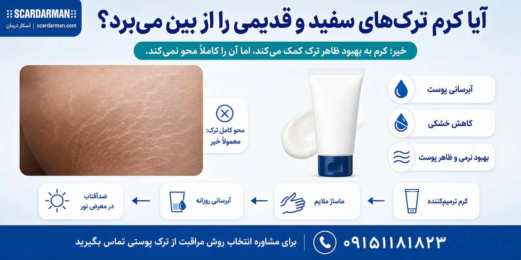 تأثیر کرم بر بهبود ظاهر ترکهای پوستی سفید و قدیمی