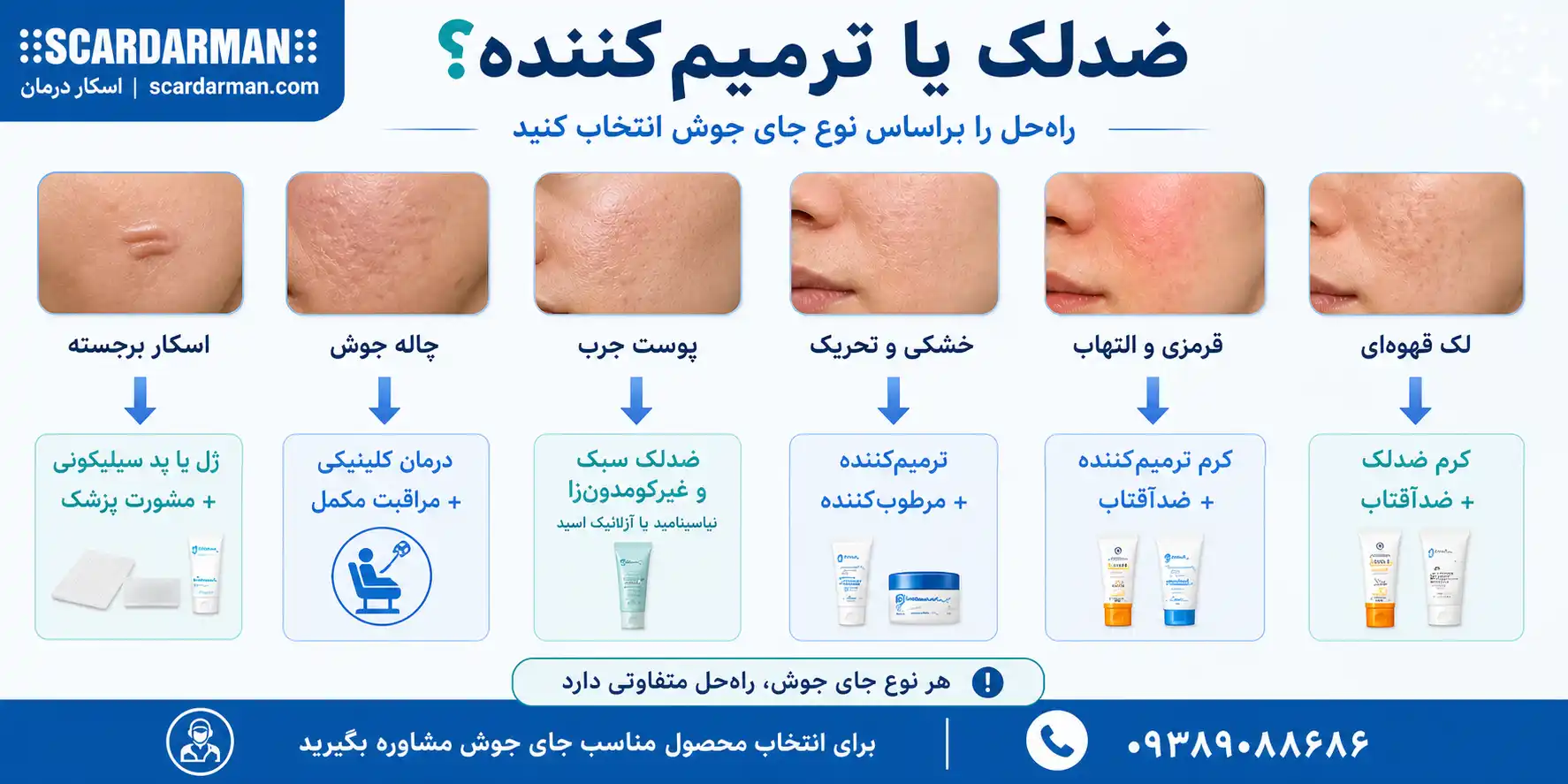 مقایسه کرم ضدلک و کرم ترمیم&zwnj;کننده برای انواع جای جوش