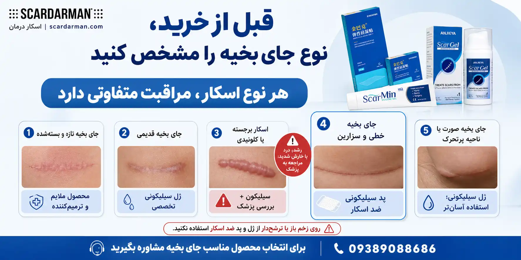 قبل از خرید کرم، نوع جای بخیه خود را مشخص کنید