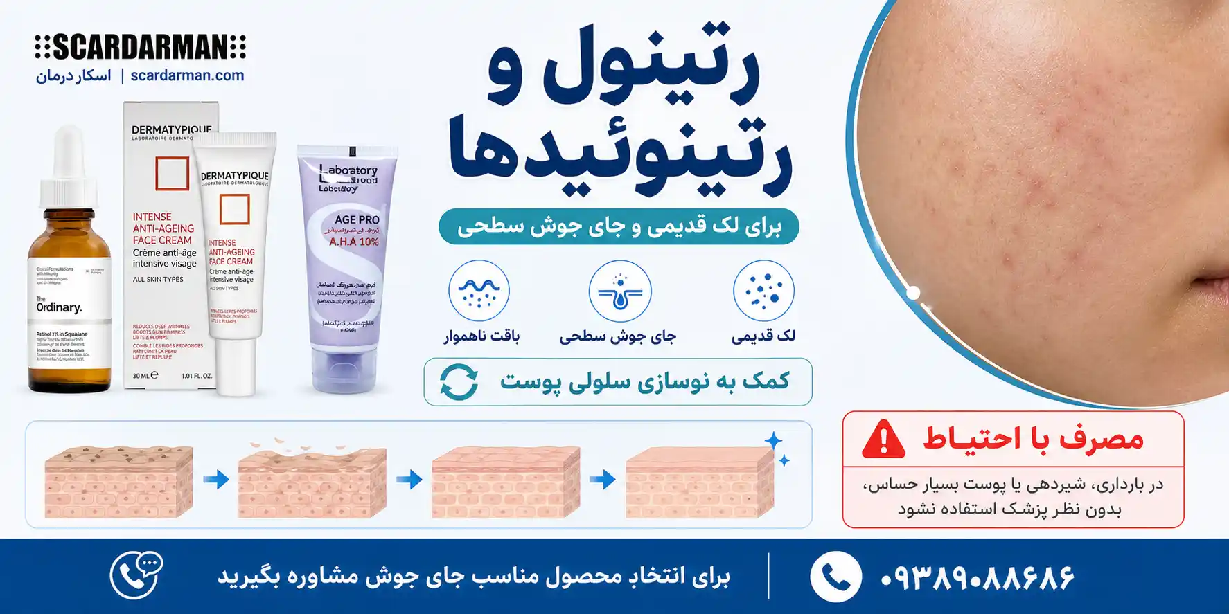 رتینول و رتینوئیدها برای بهبود لک و بافت جای جوش