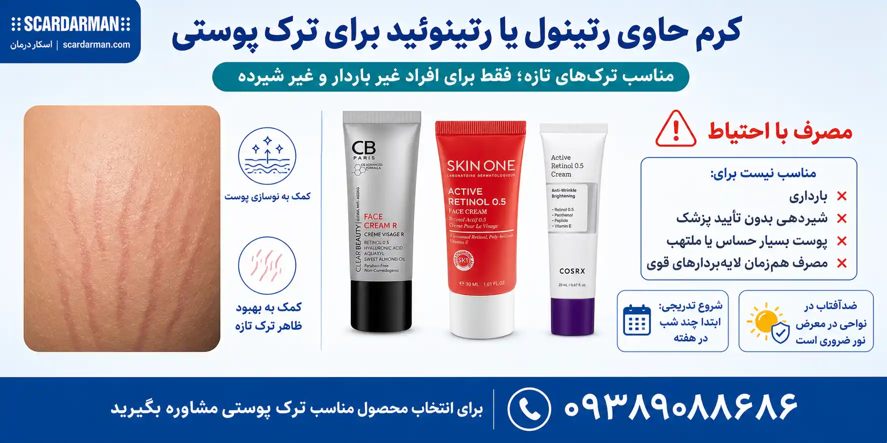 کرم های حاوی رتینول یا رتینوئید برای بهبود ظاهر ترکهای پوستی