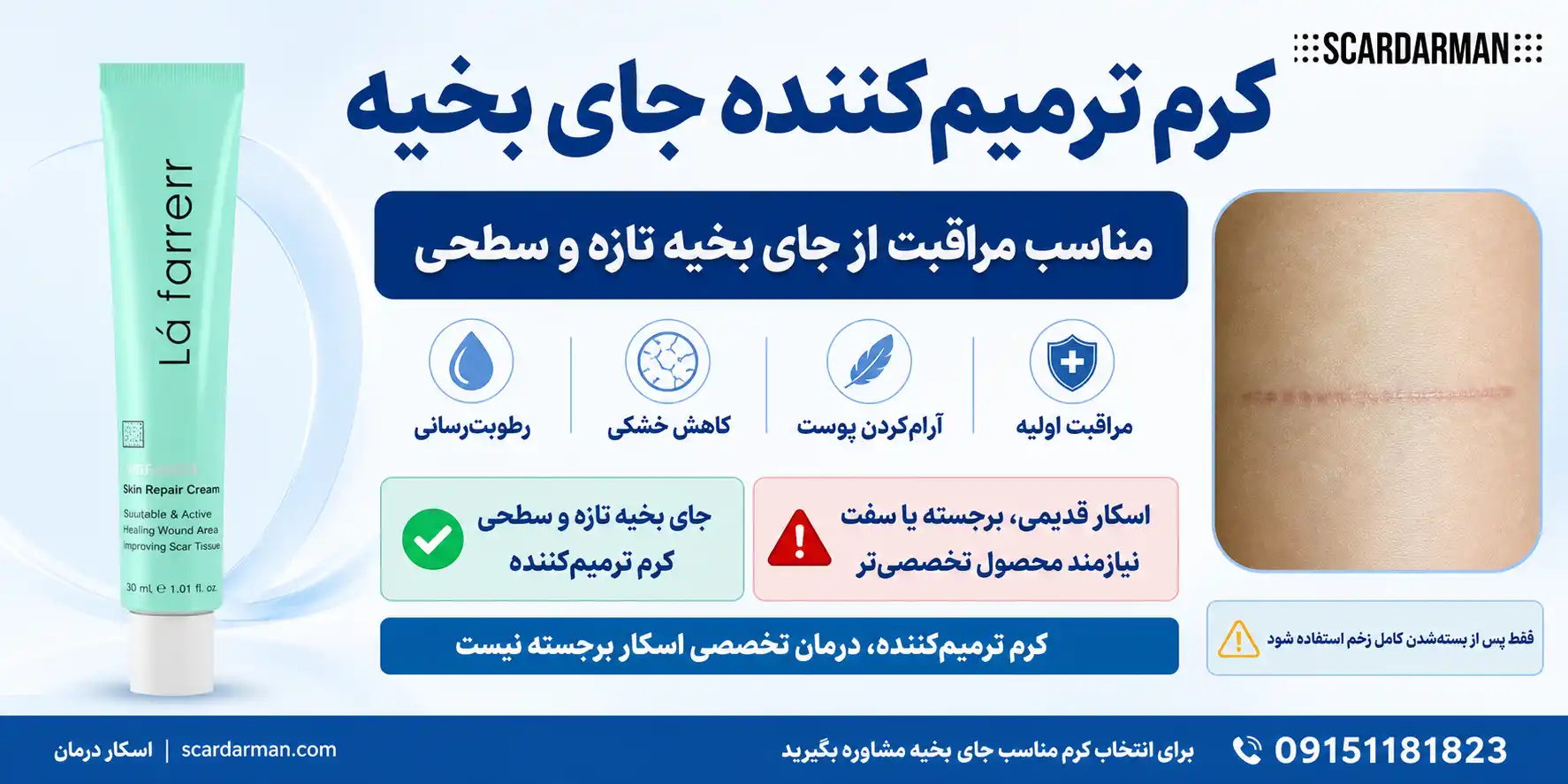 کرم ترمیم کننده جای بخیه