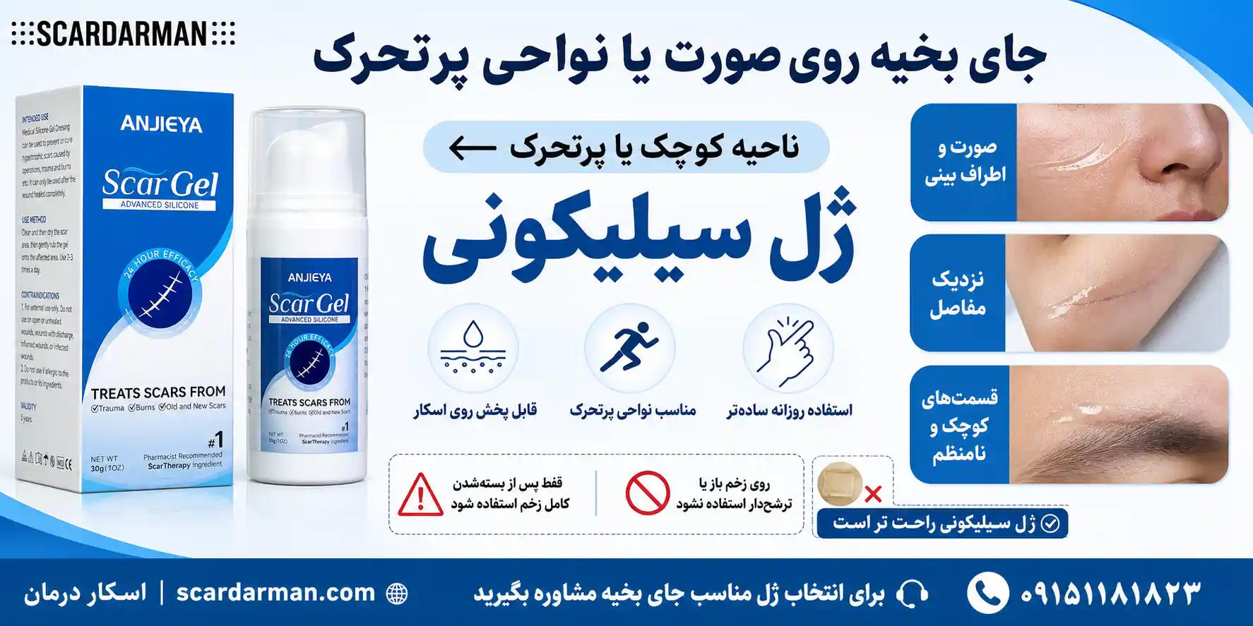 استفاده از ژل سیلیکونی برای جای بخیه صورت و نواحی پرحرکت بدن