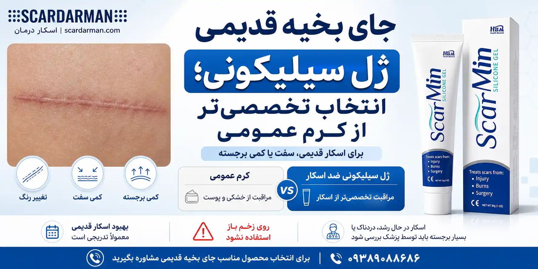 استفاده از ژل سیلیکونی ضد اسکار برای جای بخیه قدیمی و سفت&zwnj;شده