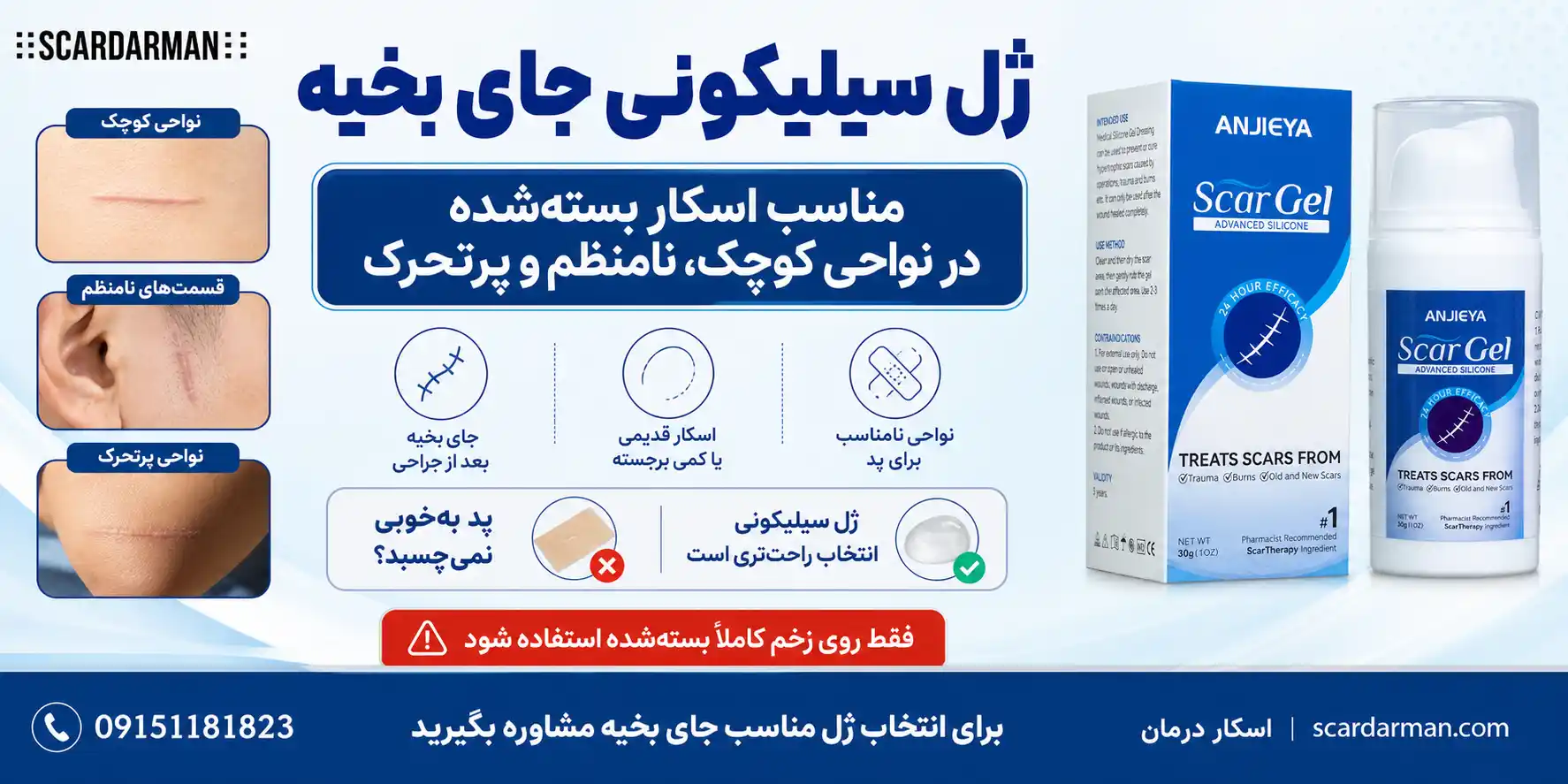 ژل سیلیکونی جای بخیه