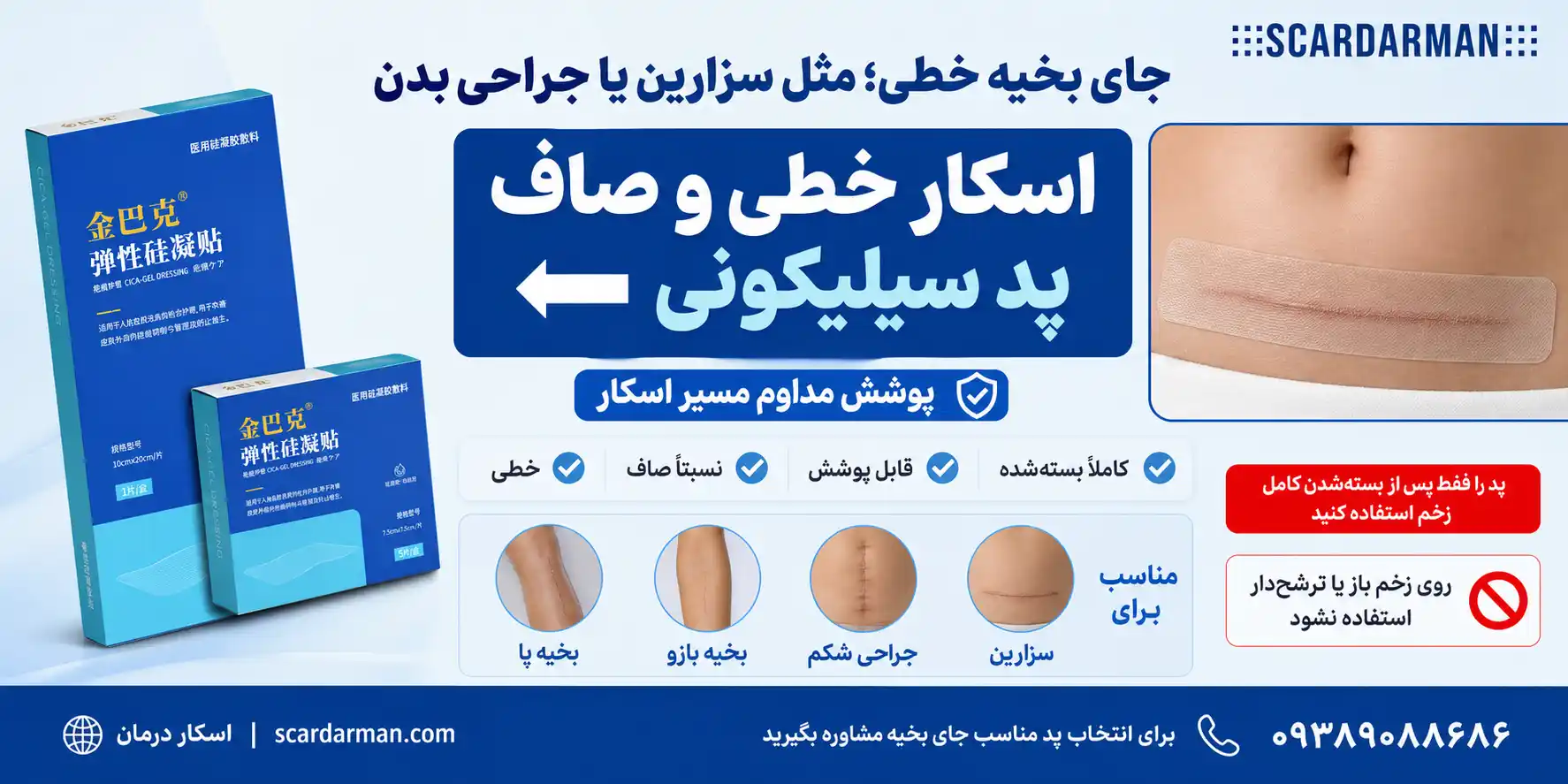 استفاده از پد سیلیکونی برای جای بخیه خطی سزارین و جراحی بدن