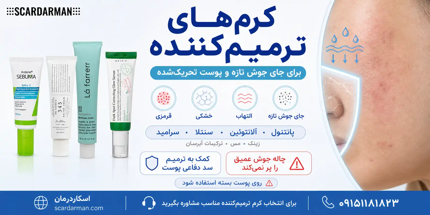 کرم&zwnj;های ترمیم&zwnj;کننده برای قرمزی، خشکی و التهاب جای جوش