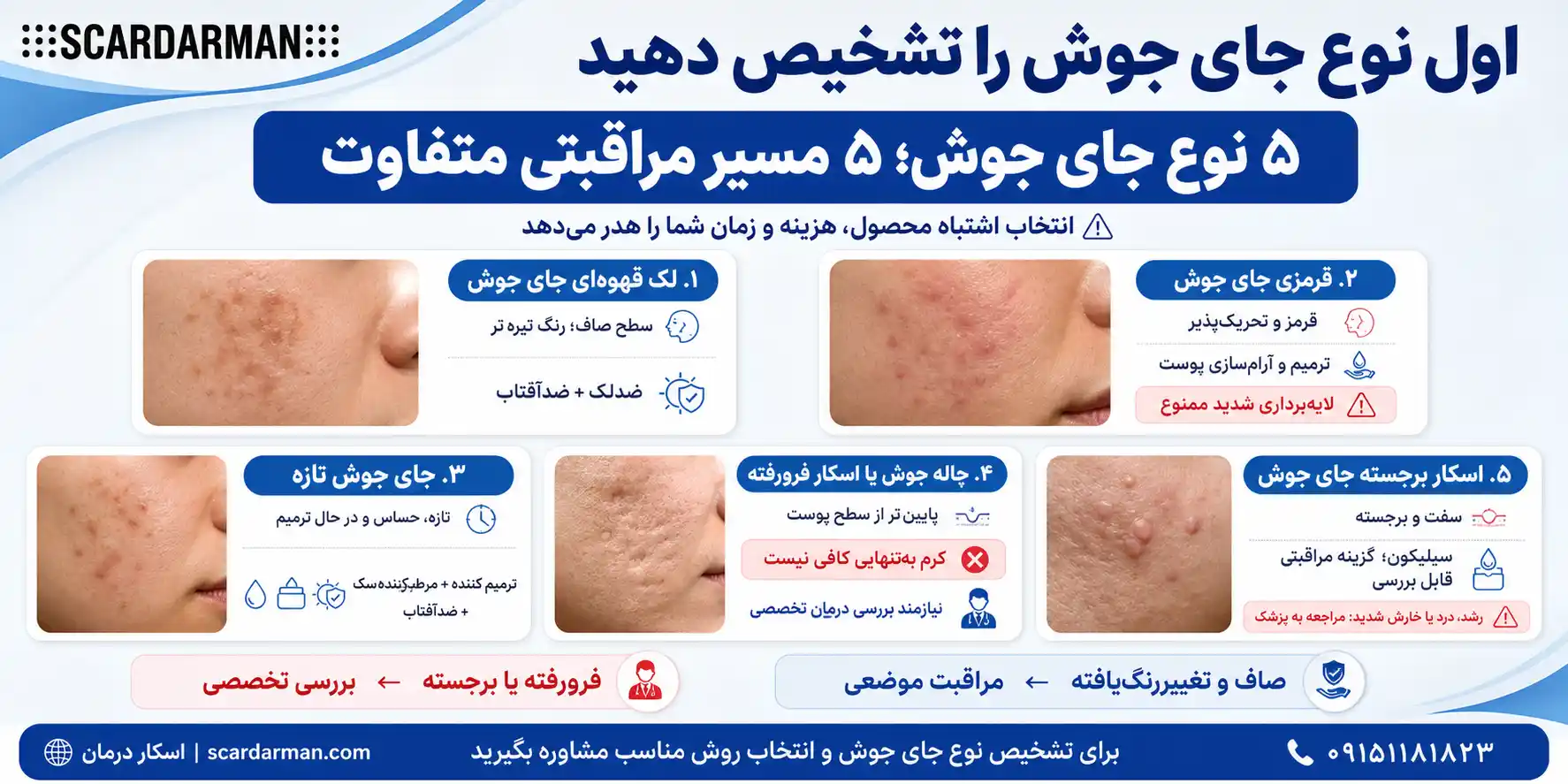 تشخیص انواع جای جوش صورت برای انتخاب محصول مناسب