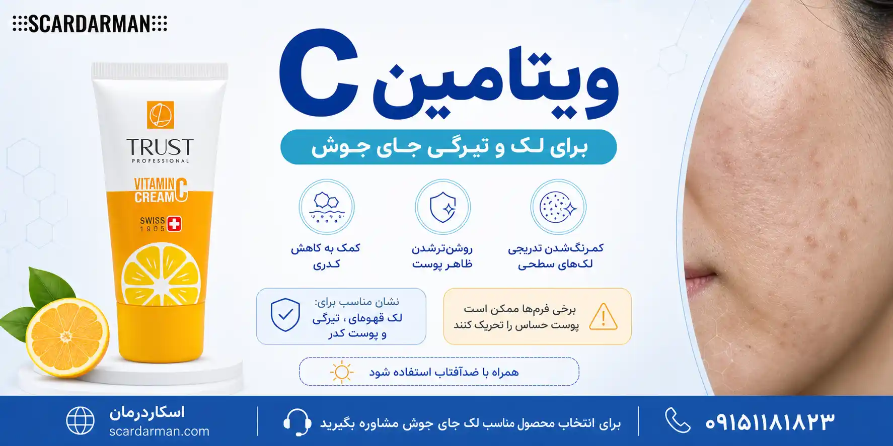 ویتامین C برای کاهش لک و تیرگی جای جوش صورت