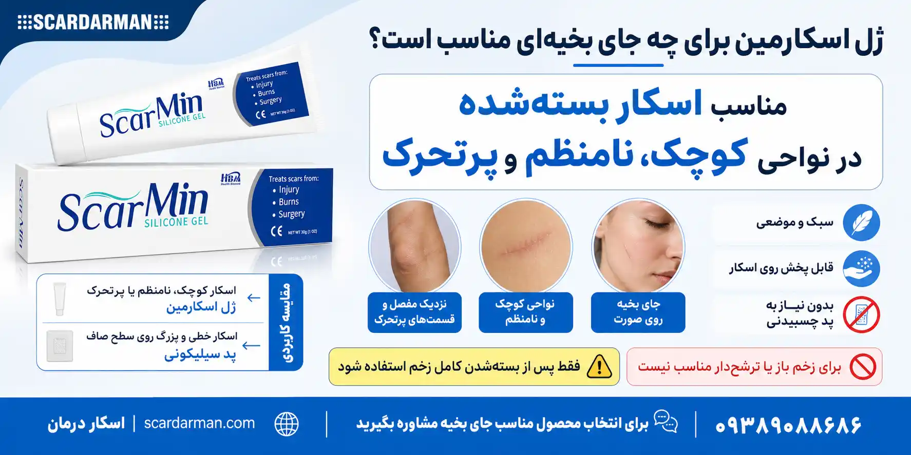 ژل اسکار مین برای چه جای بخیه ای مناسب است؟