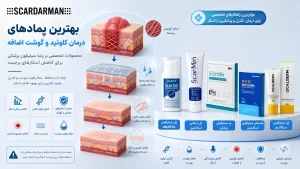 بهترین پماد های درمان کلوئید و گوشت اضافه