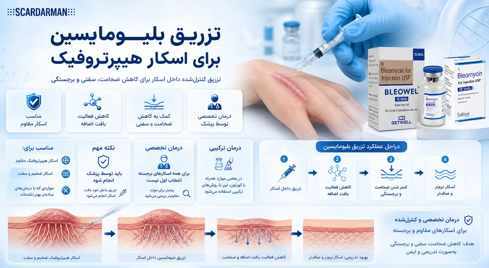 تزریق بلیومایسین برای اسکار هیپرتروفیک