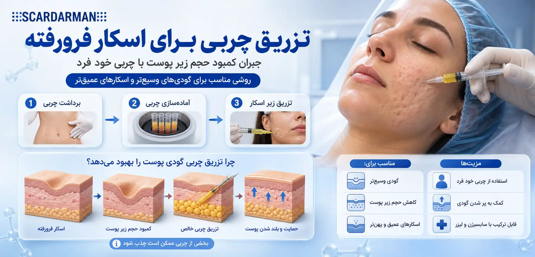 تزریق چربی برای اسکار فرورفته