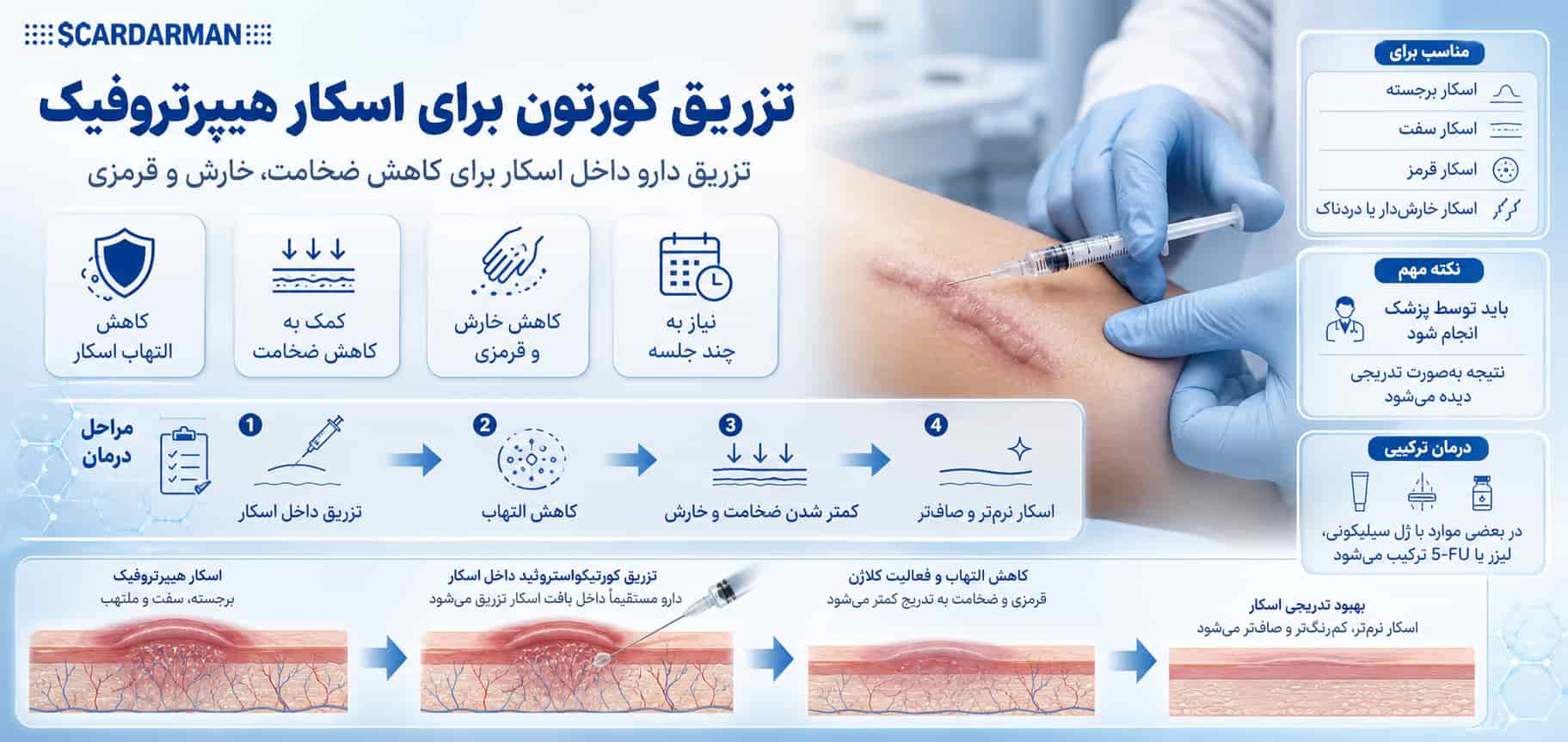 تزریق کورتون برای اسکار هیپرتروفیک
