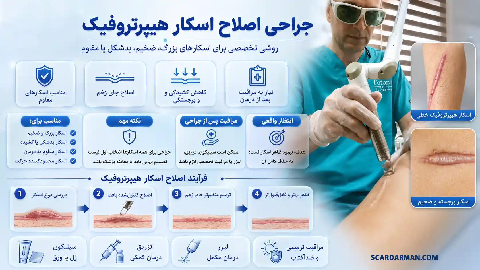 جراحی اصلاح اسکار هیپرتروفیک