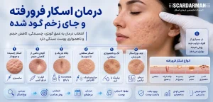 درمان اسکار و جای زخم گود شده