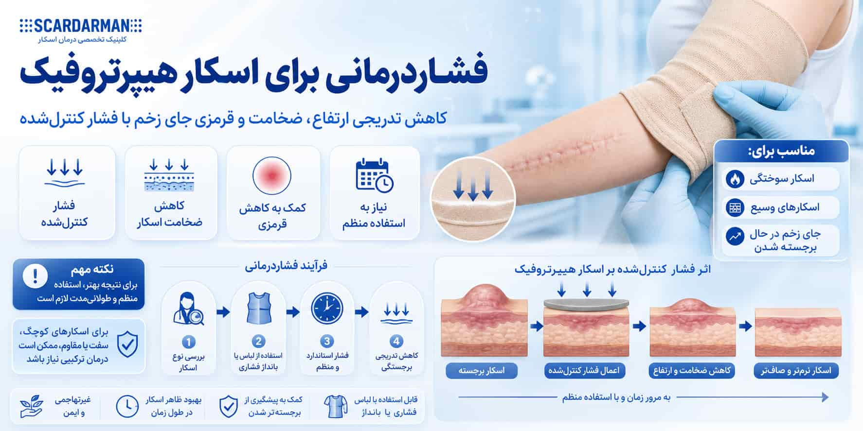 فشار درمانی برای درمان اسکار هیپرتروفیک