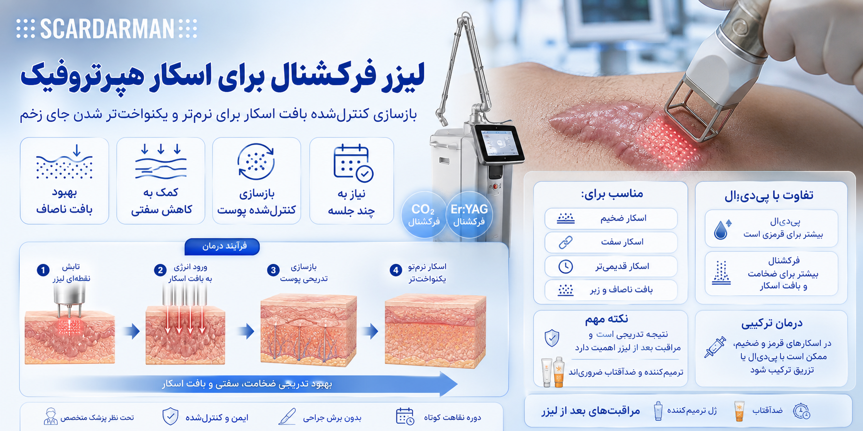 لیزرفرکشنال برای اسکار برجسته