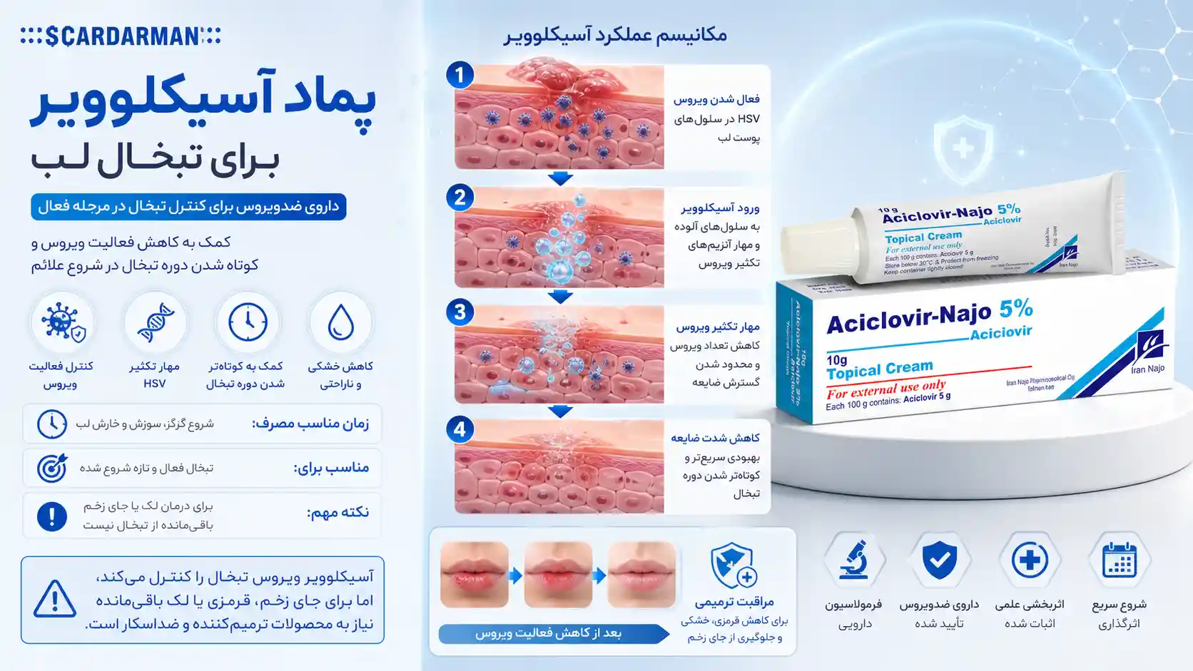 پماد آسیکلوویر برای درمان تبخال