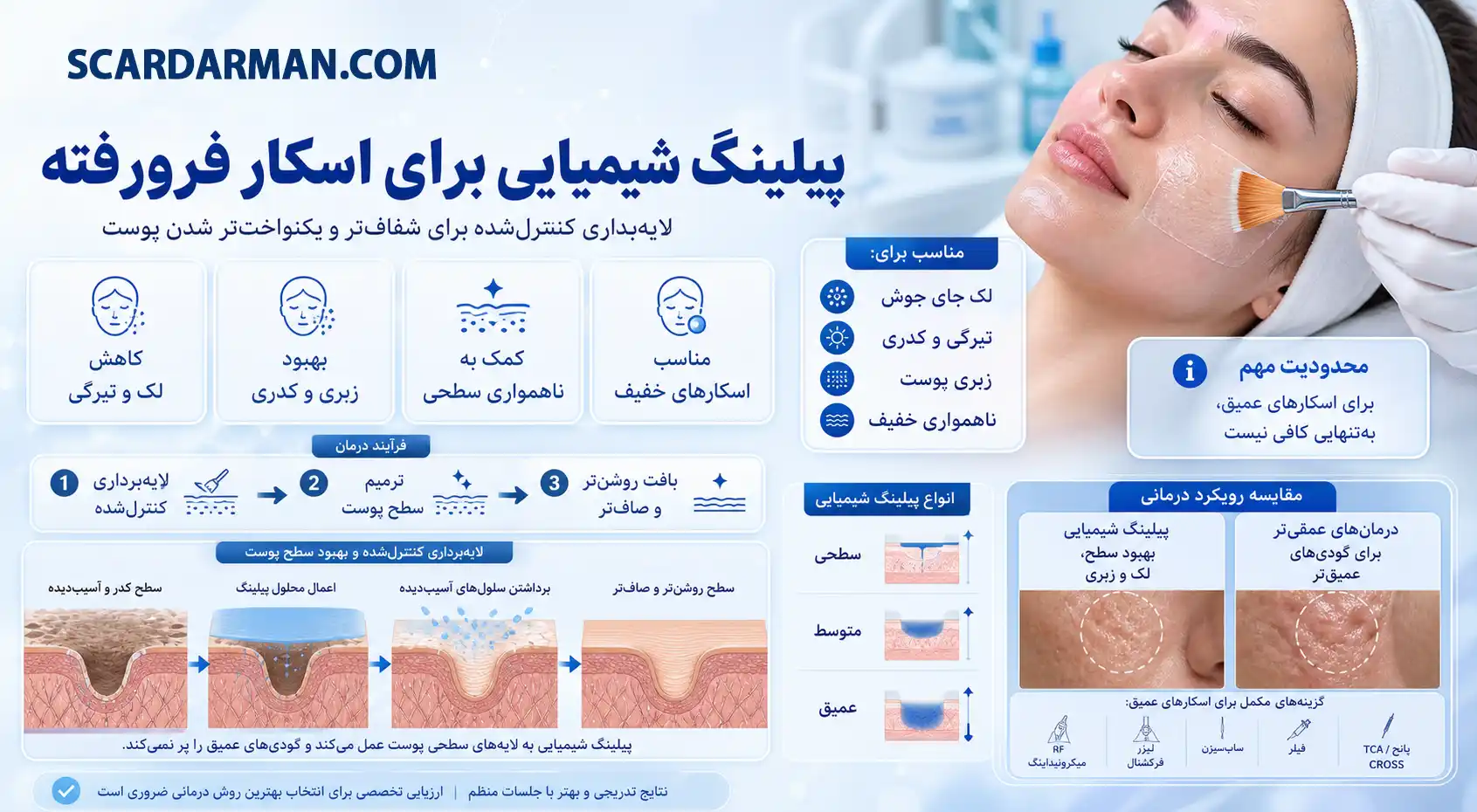 پیلینگ شیمیایی برای درمان اسکار فرورفته