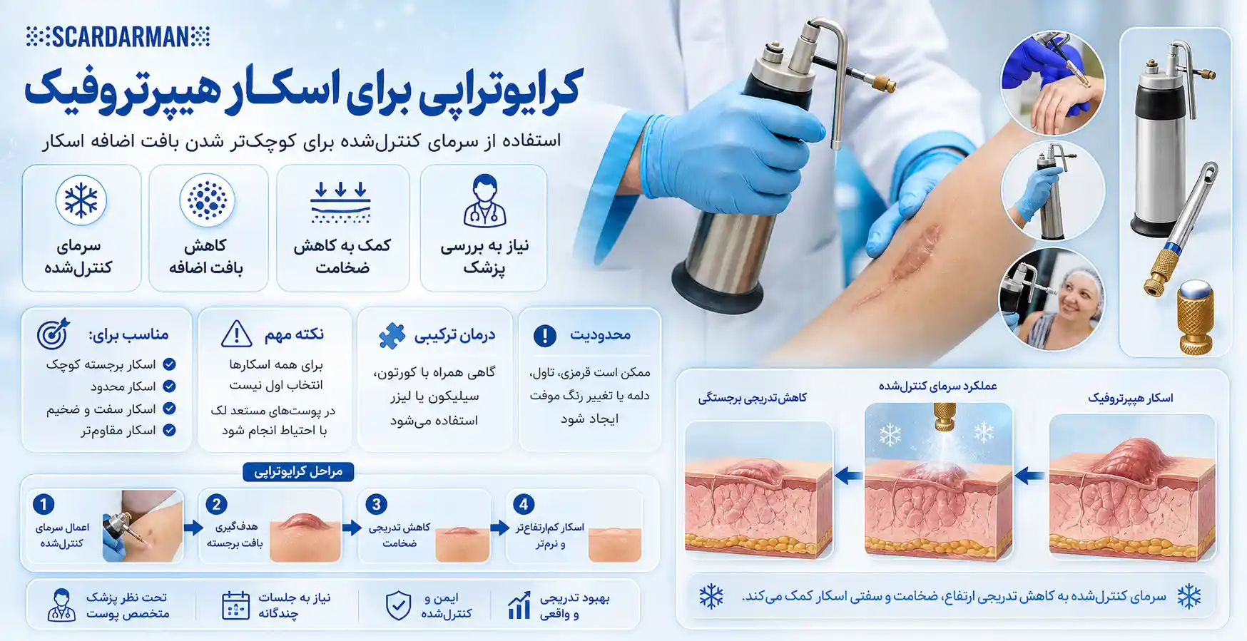 کرایوتراپی برای اسکار هیپرتروفیک