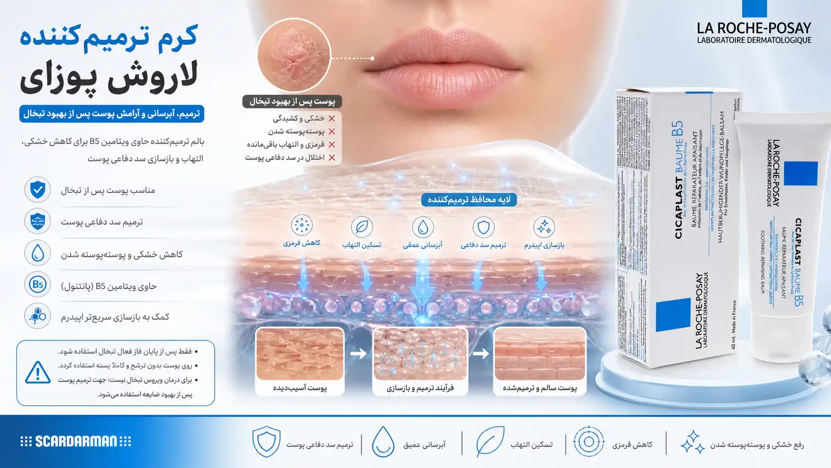 کرم ترمیم کننده لاورش پوزای
