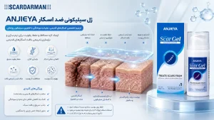 ANJIEYA ژل سیلیکونی ضد اسکار