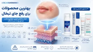 بهترین پماد برای از بین بردن جای تبخال
