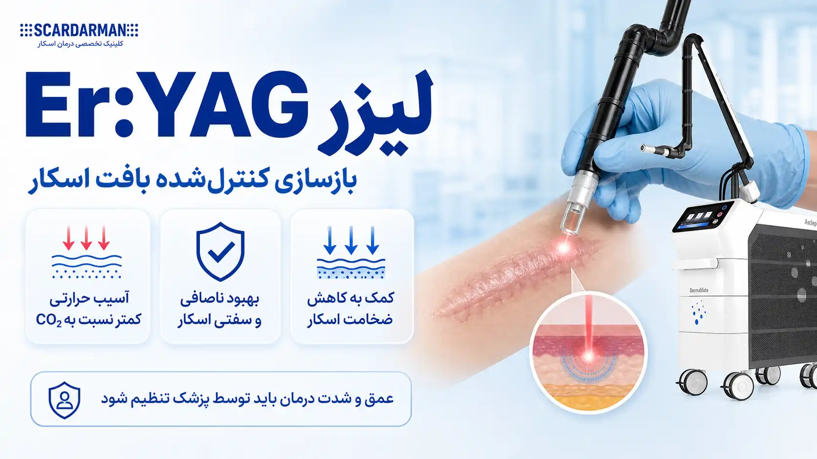 لیزر Er:YAG