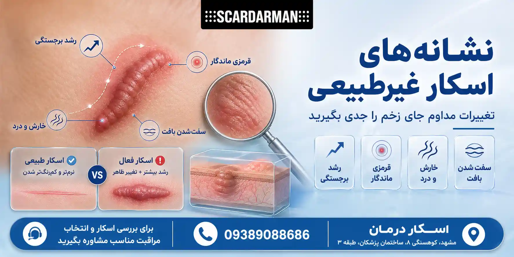 نشانههای غیرطبیعی در برجسته شدن جای زخم