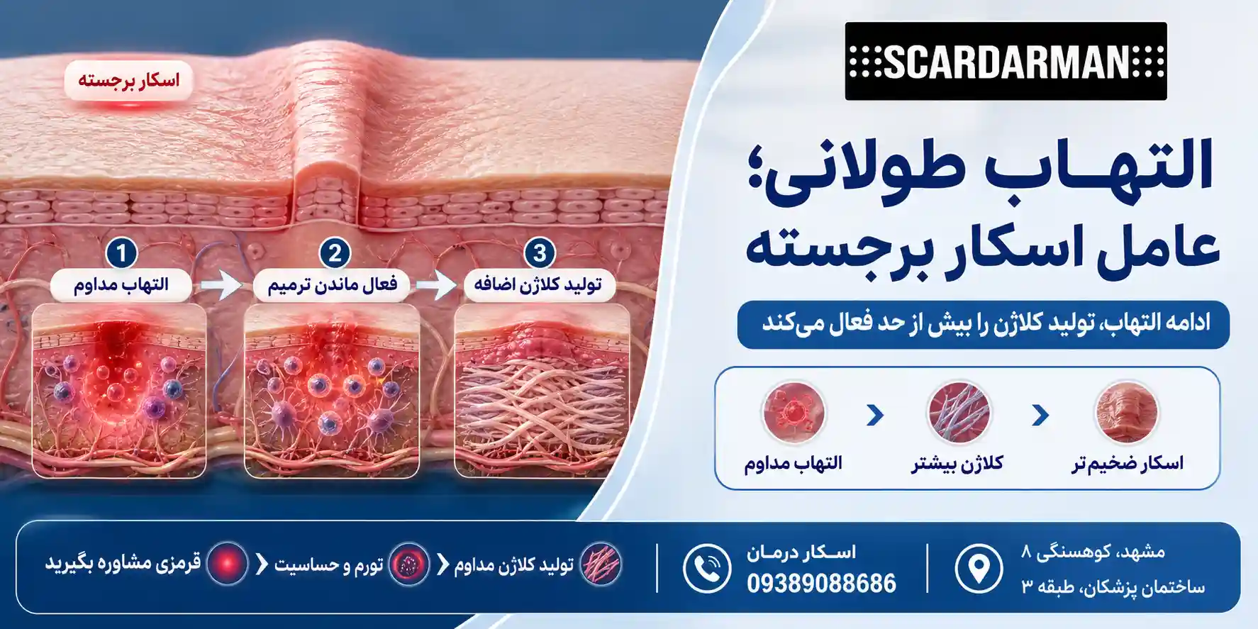 التهاب طولانی و تأثیر آن روی برجسته شدن زخم