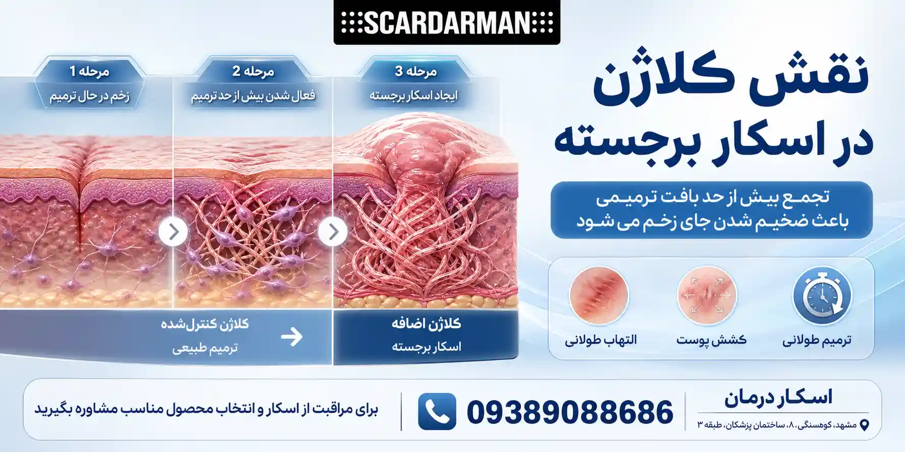 نقش کلاژن در اسکار برجسته
