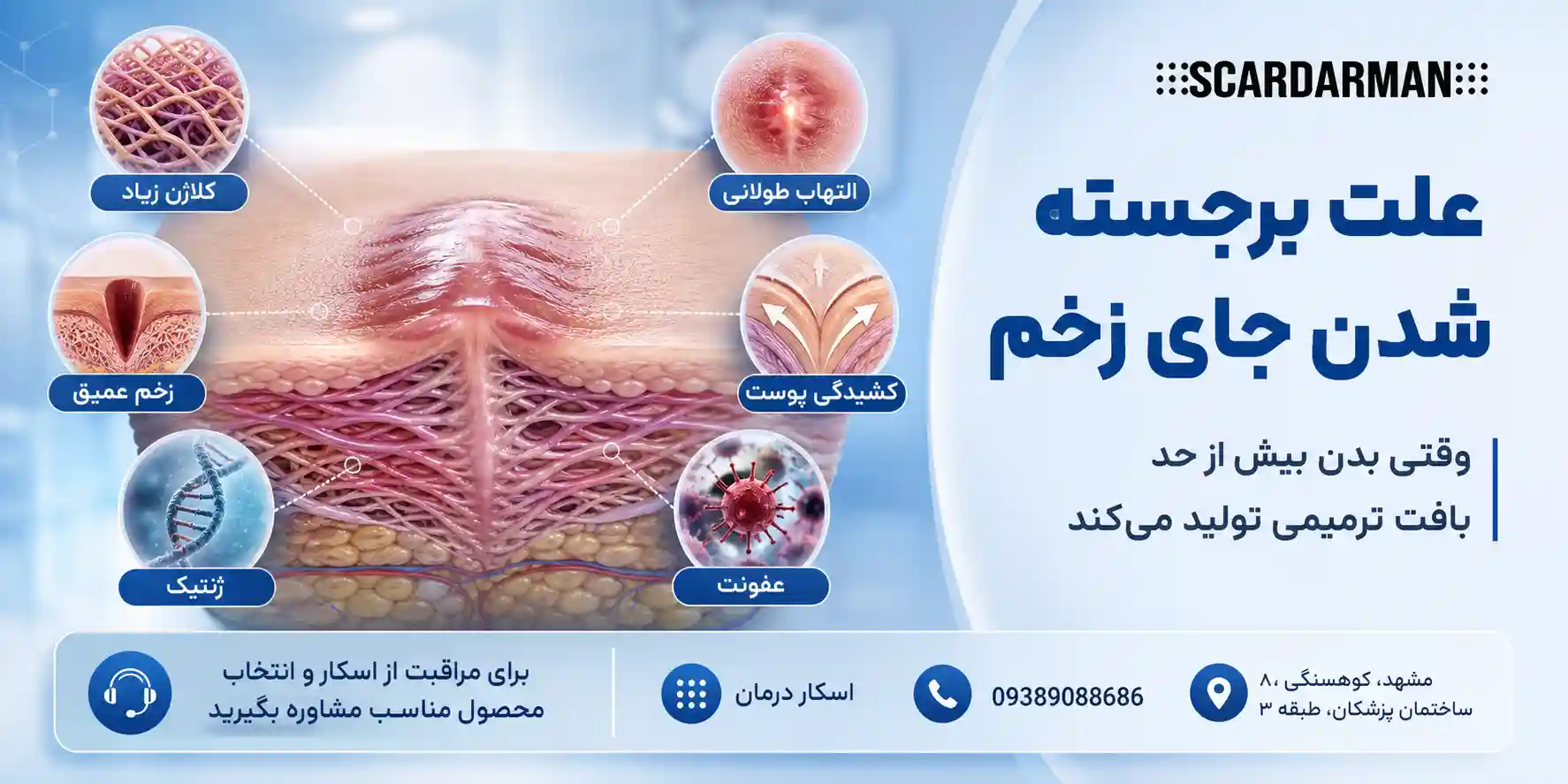 علت برجسته شدن جای زخم