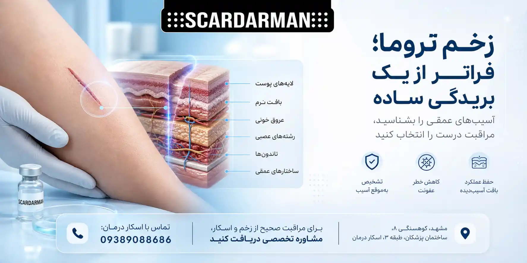 زخم تروما