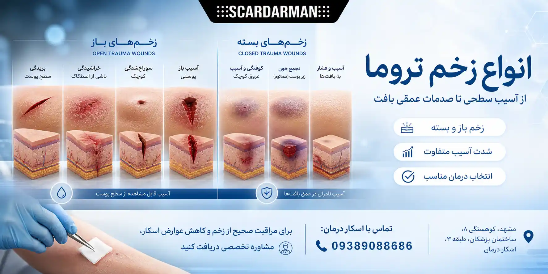 انواع زخم تروما